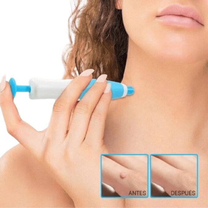 (1)Kit Quita verrugas con accesorios