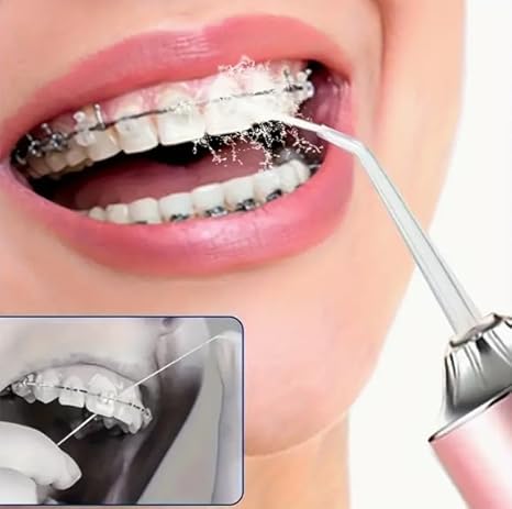 IRRIGADOR DENTAL