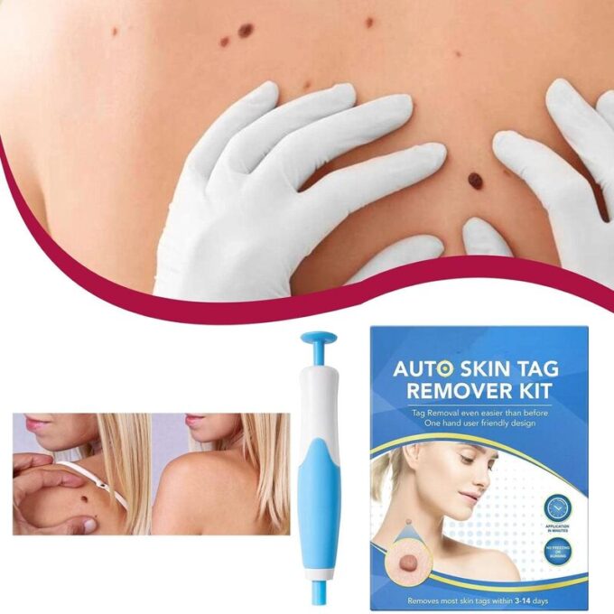 (1)Kit Quita verrugas con accesorios