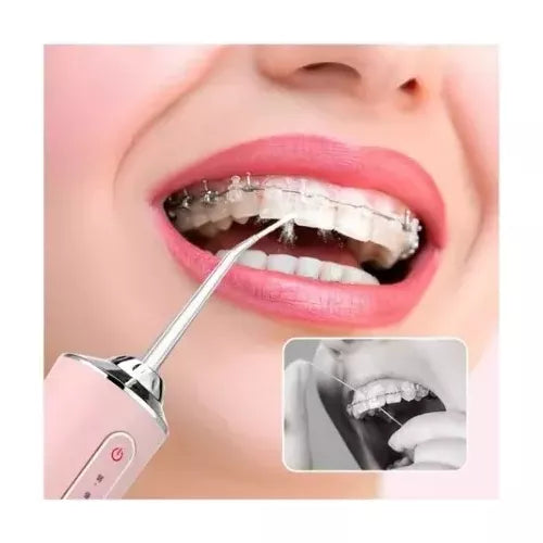 Irrigador Oral Dental Portátil Recargable USB 4 Boquillas Limpieza Pro