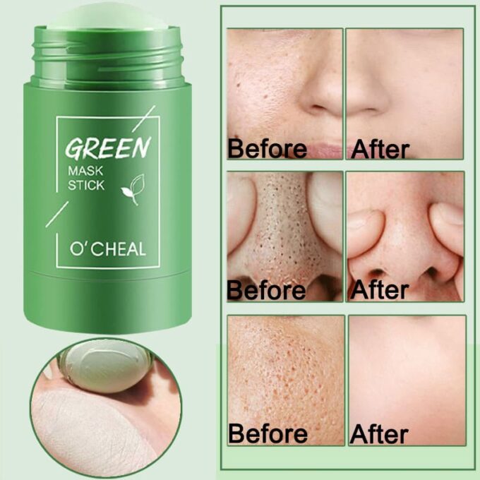 (1)Mascarilla facial Meidian de rodillo para piel