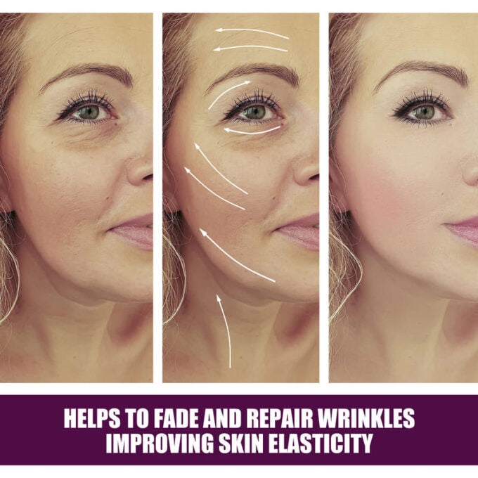 (1)Parche facial antiarrugas