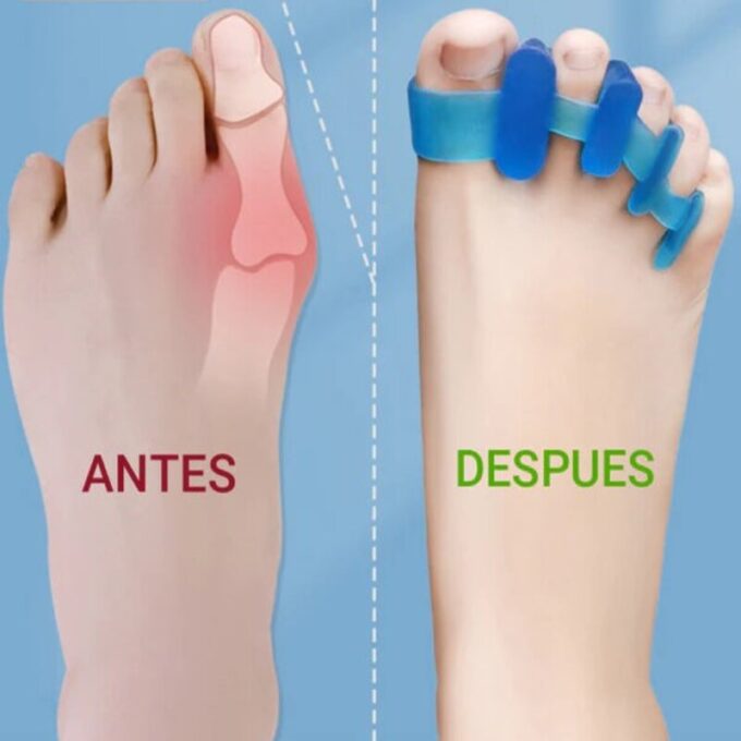 (1)Separador de silicona para dedos